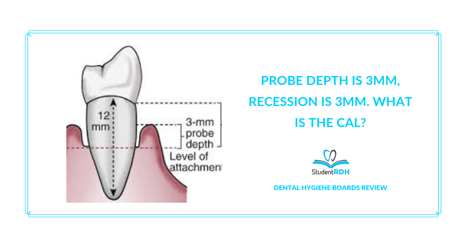 Probe depth is 3mm, recession is 3mm. What is the CAL? StudentRDH Blog