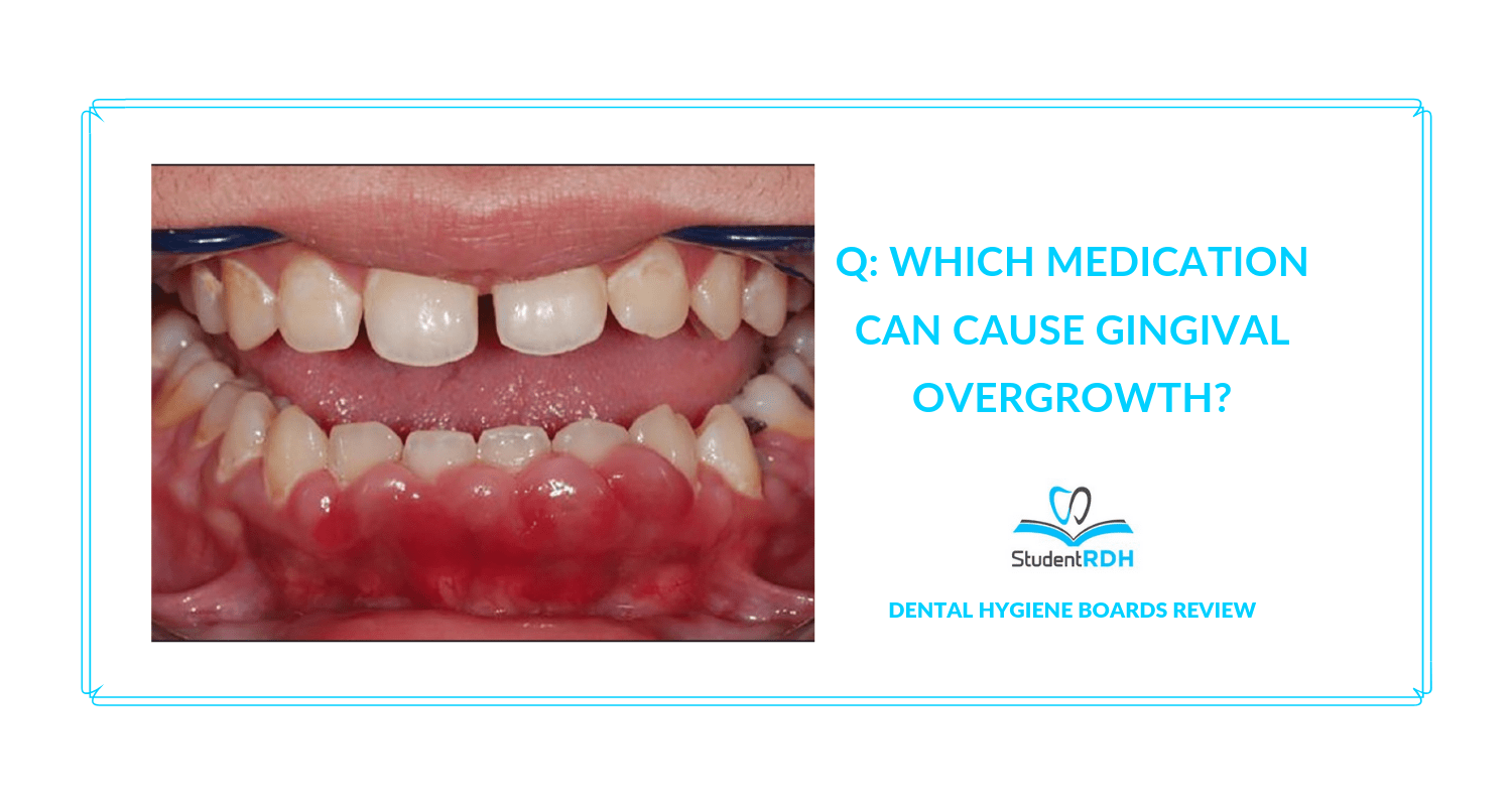Q Which medication can cause gingival overgrowth? StudentRDH Blog