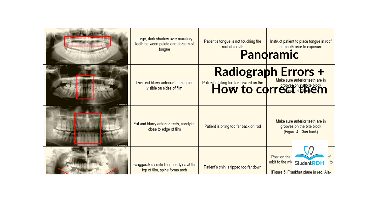 Panoramic Radiograph Errors + How to correct them StudentRDH Blog