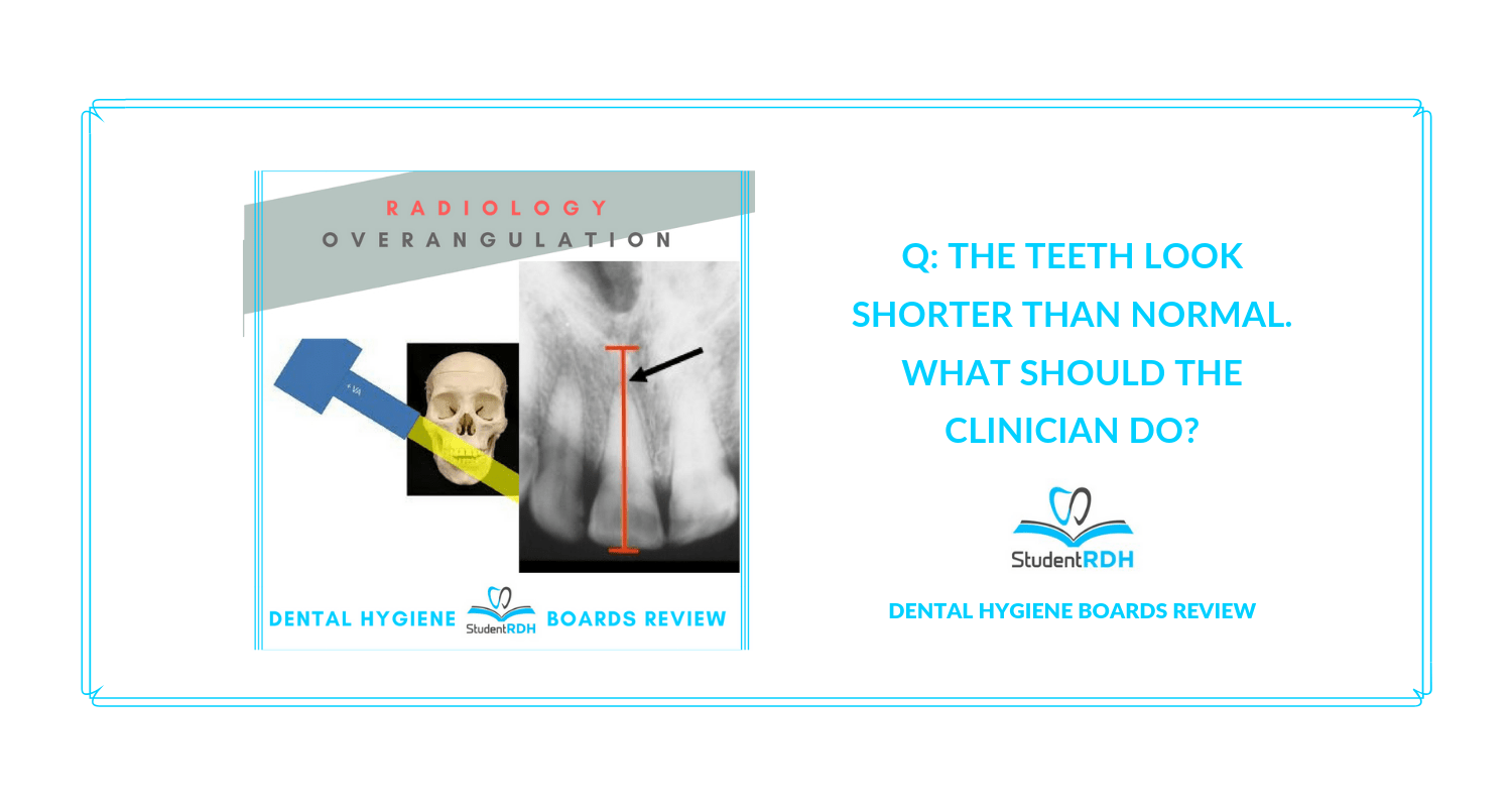 Q The teeth look shorter than normal. What should the clinician do