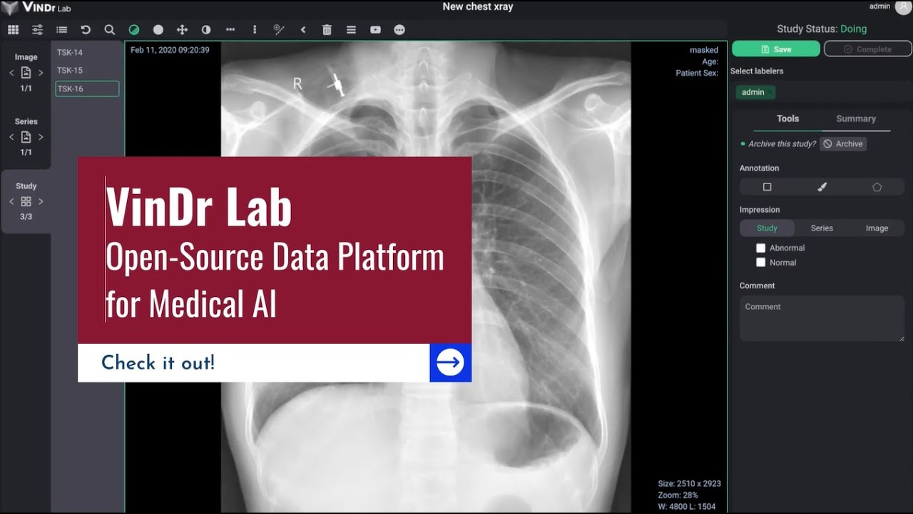 VinDr Lab phần mềm mã nguồn mở cho cộng đồng Xử lý ảnh y tế