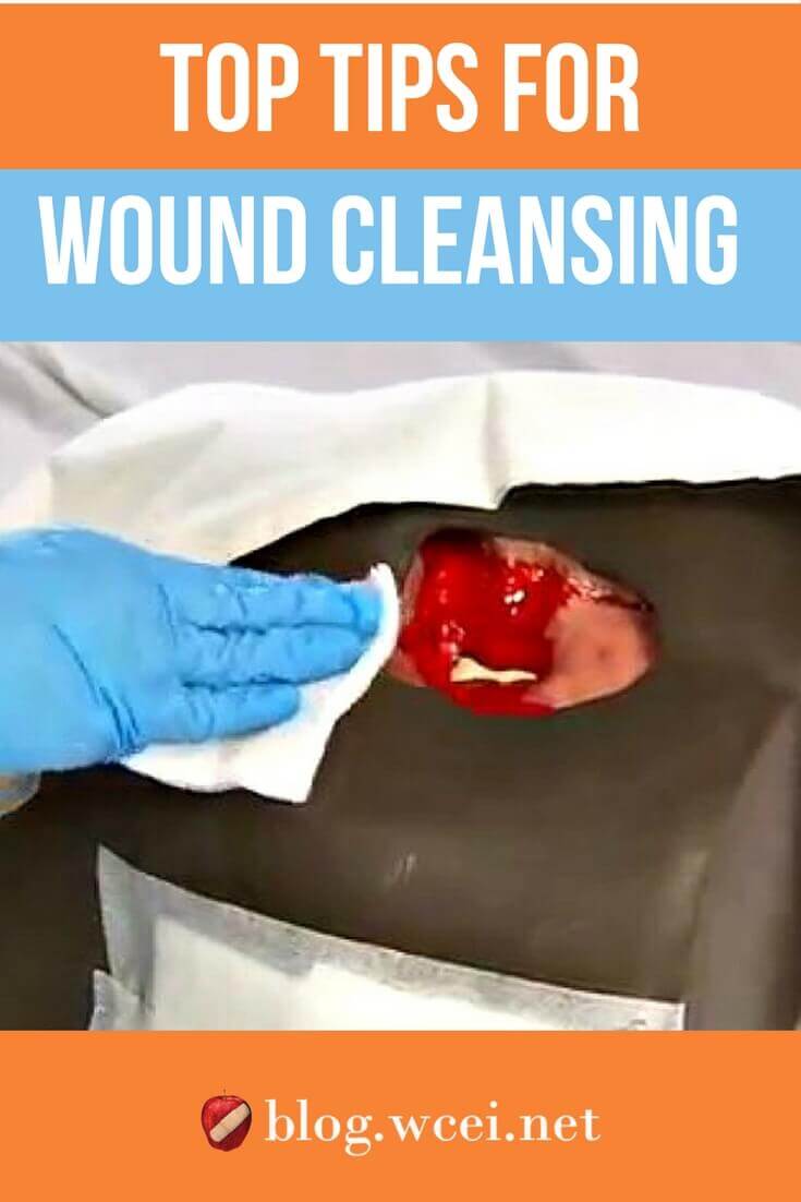 Top Tips for Best Wound Cleansing Practices WCEI Blog WCEI Blog