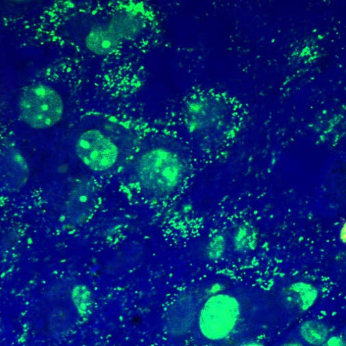 Mycoplasma Contamination In Cell Culture