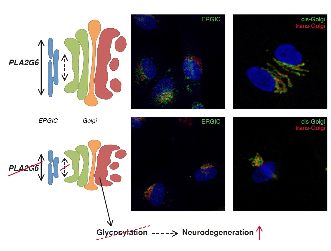 Disruption of Golgi morphology and altered protein glycosylation in