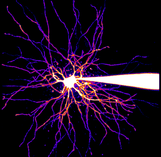 TC neuron 2 Neurocircuits Lab
