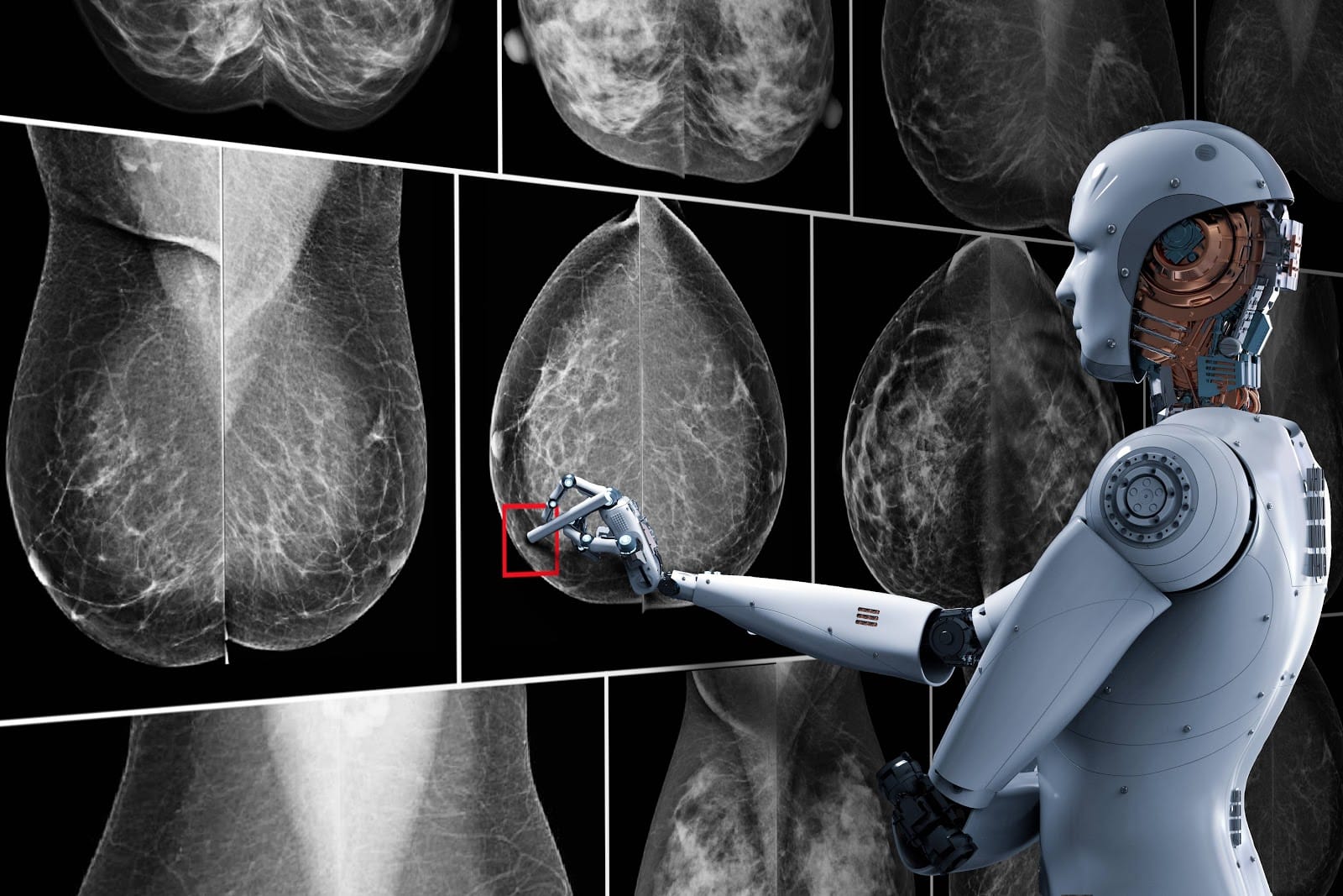 AI Improves Breast Cancer Diagnoses NVIDIA Blog