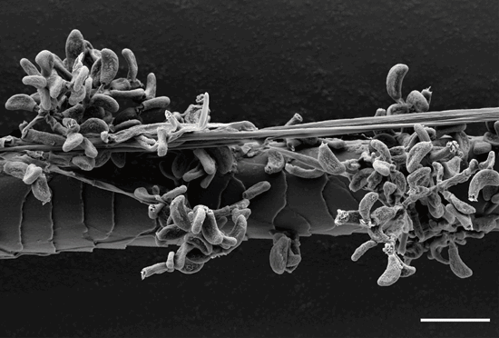 WhiteNose Syndrome Kills Social Bats Most Frequently Science