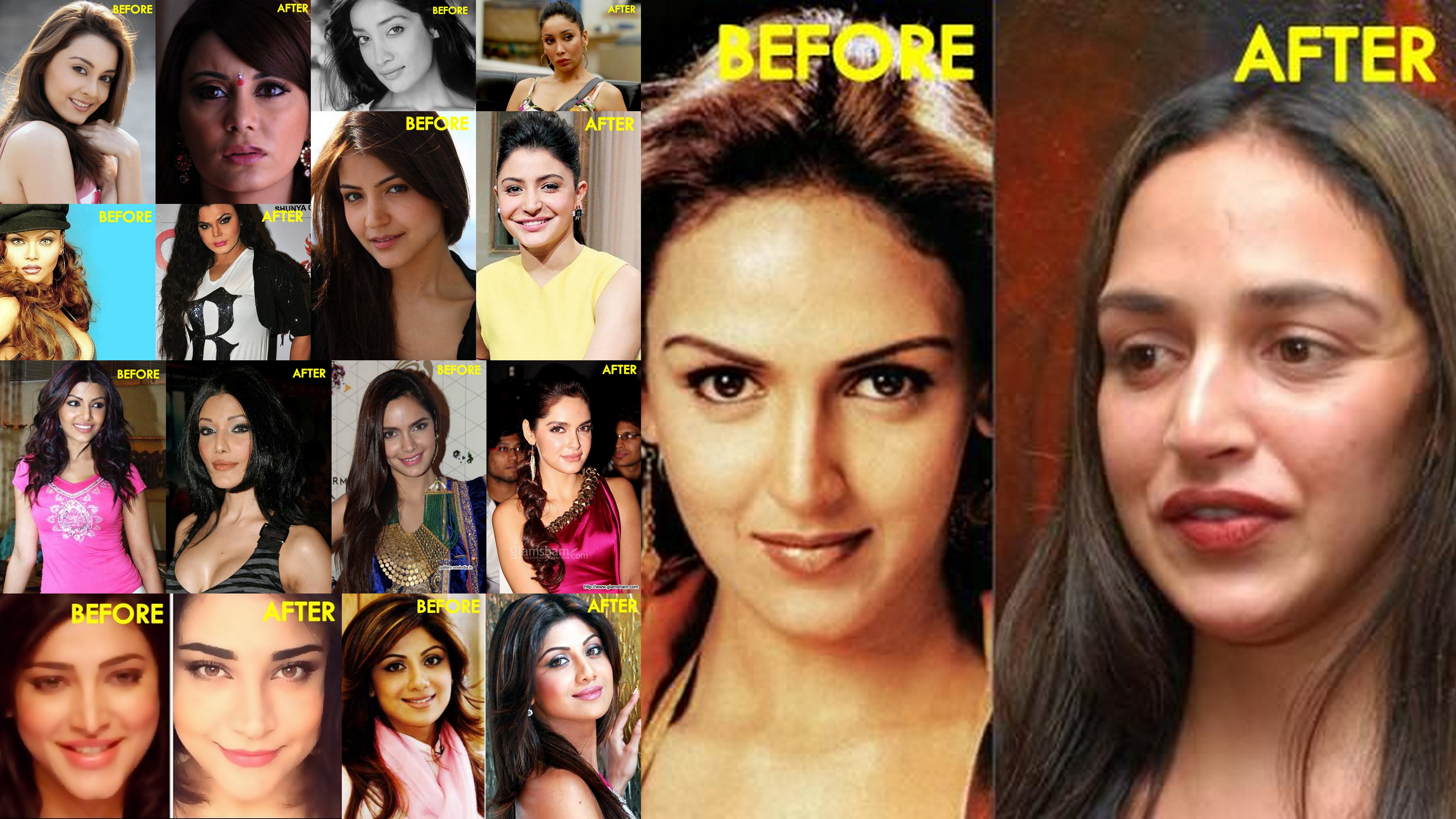10 Bollywood Celebrities With Worst Plastic Surgeries