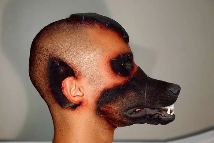 Mitad humano, mitad perro La verdad del hombre que se ‘transplantó’ la
