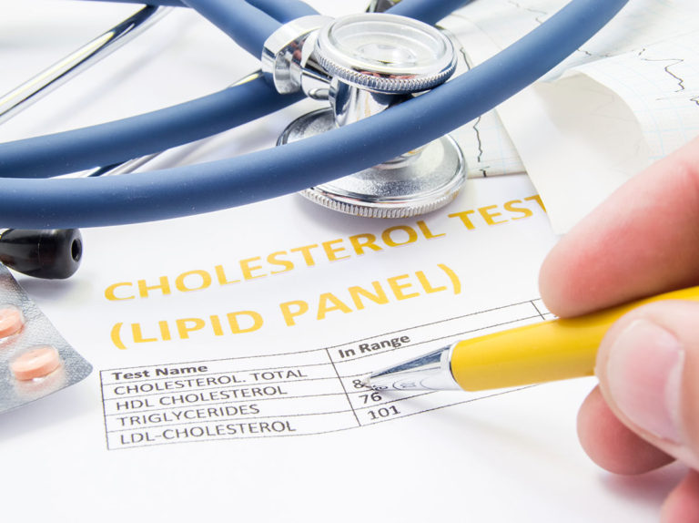 Lipid Panel Test Quick Facts When and why to test your cholesterol Bloodscore
