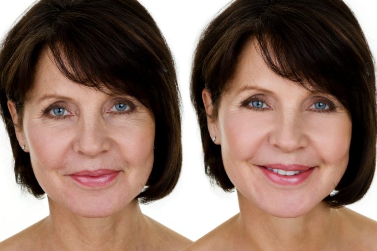 Cosmetic Dermatology Bloomfield Laser and Cosmetic Dermatology Centre