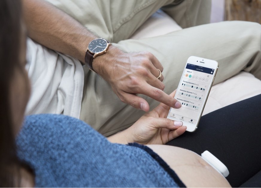 Contraction Monitor for High Risk Pregnancy