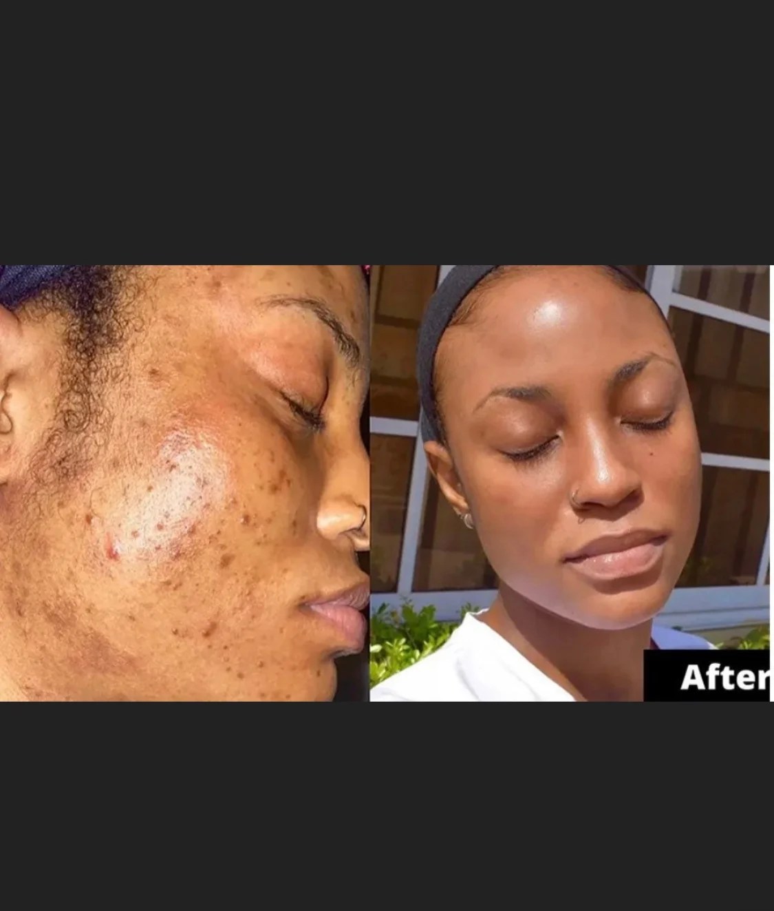 Turmeric Face Mask Bloommiracle