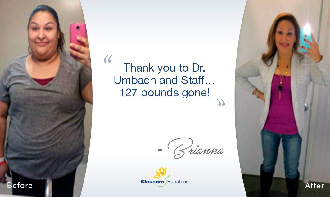 127 Pounds Gone! Blossom Bariatrics