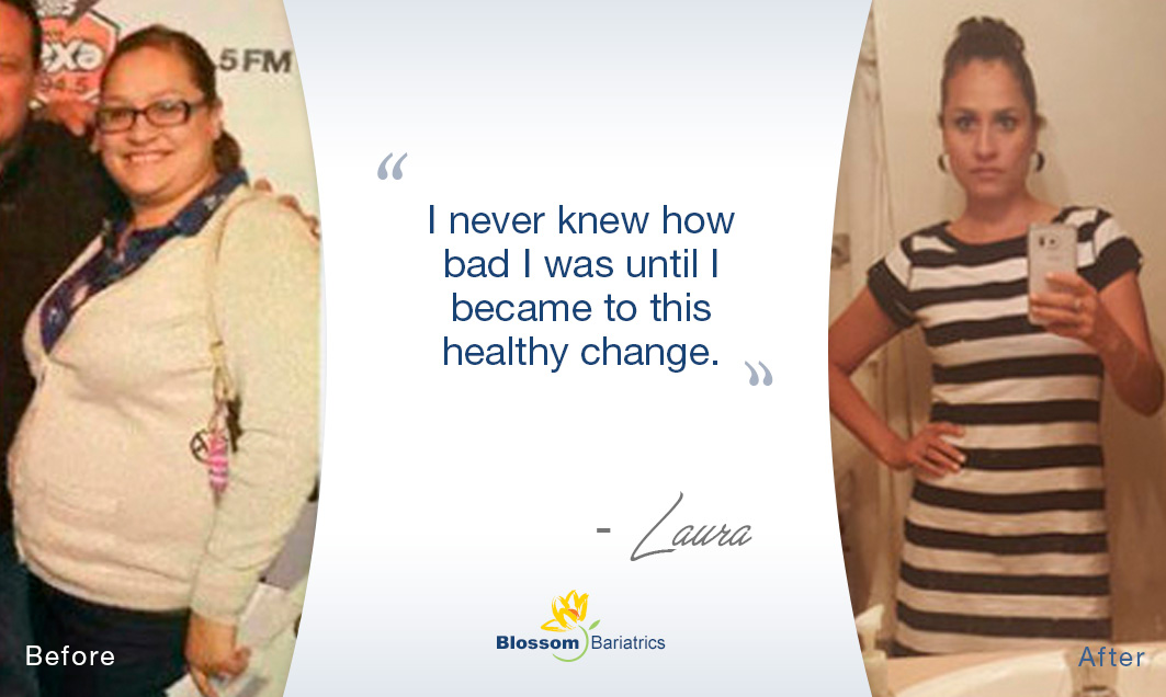 From Size 18 to Size 4 Blossom Bariatrics