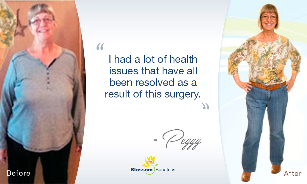 Lifesaving Experience Blossom Bariatrics