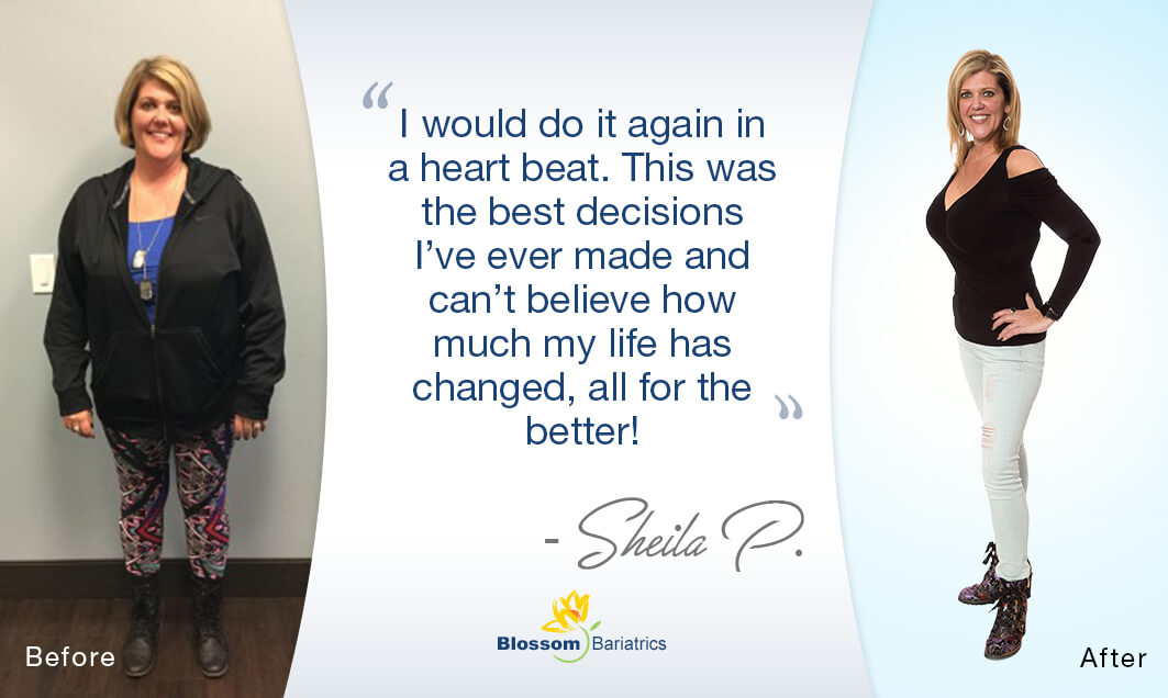 Sheila's Weight Loss Journey* Blossom Bariatrics