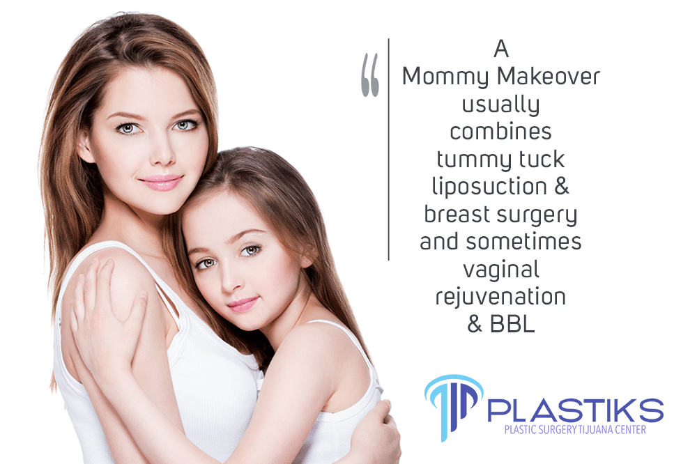 Candidate for A Mommy Makeover Plastic Surgery in Tijuana