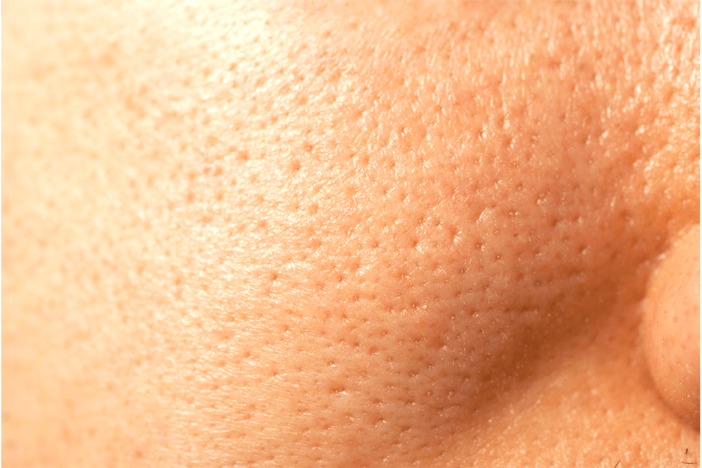 5 Healthy ways to shrink open pores on your face, including ice cubes