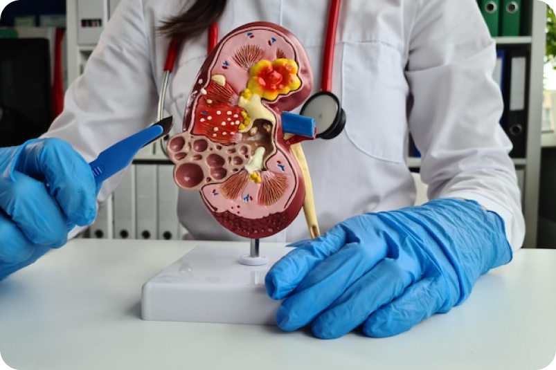 Trial investigation IntraUreteric Stent on a string Vs. Conventional