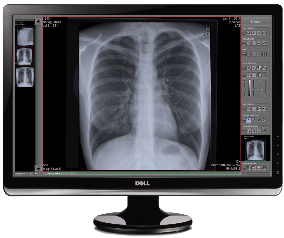 PINNACLE® CareView® Family of DR Panels Blue Ridge Imaging Technologies