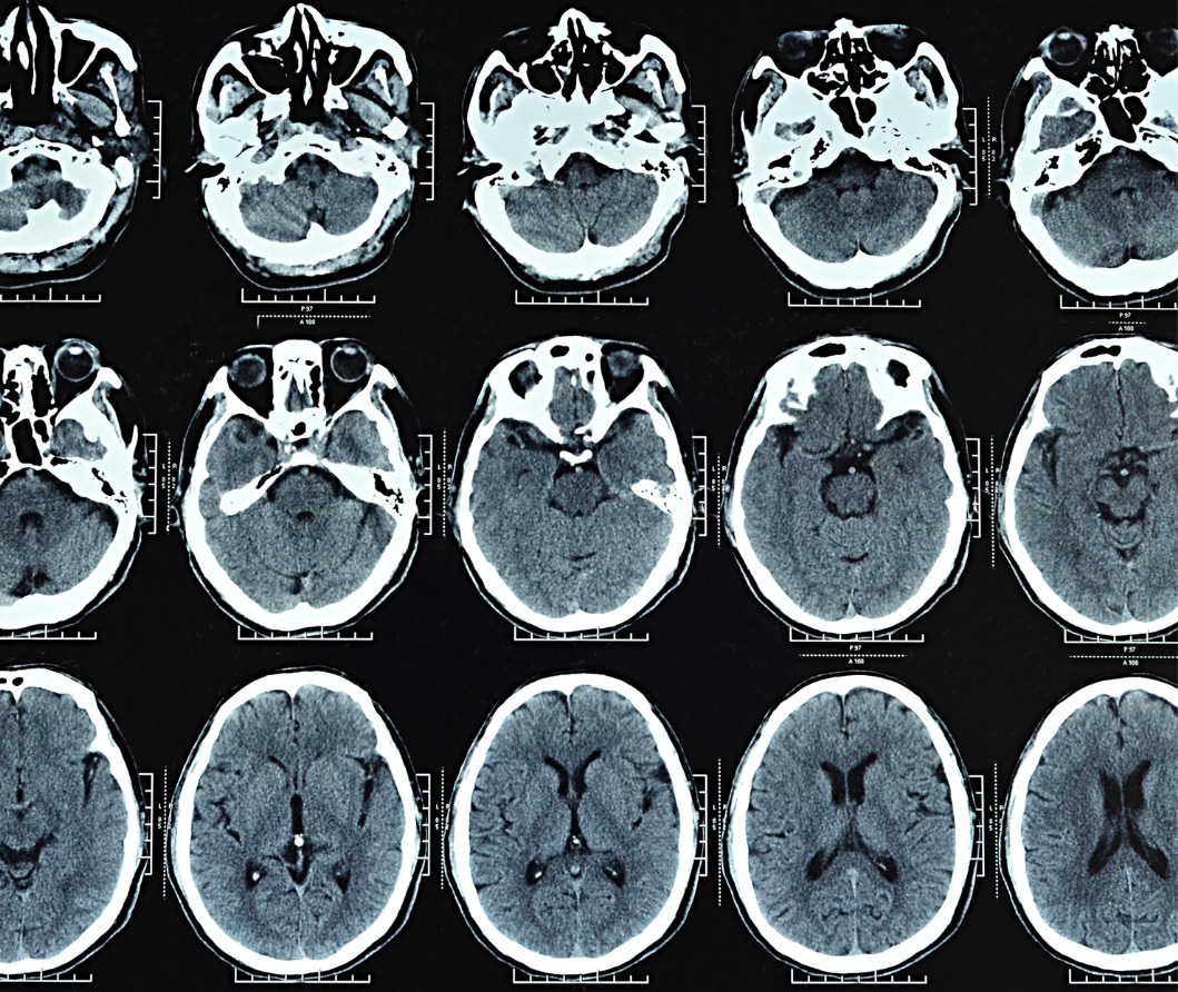 CT vs MRI Blue Rock Medical