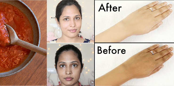 How To Get rid of Sun Tan Naturally From Face & Arms
