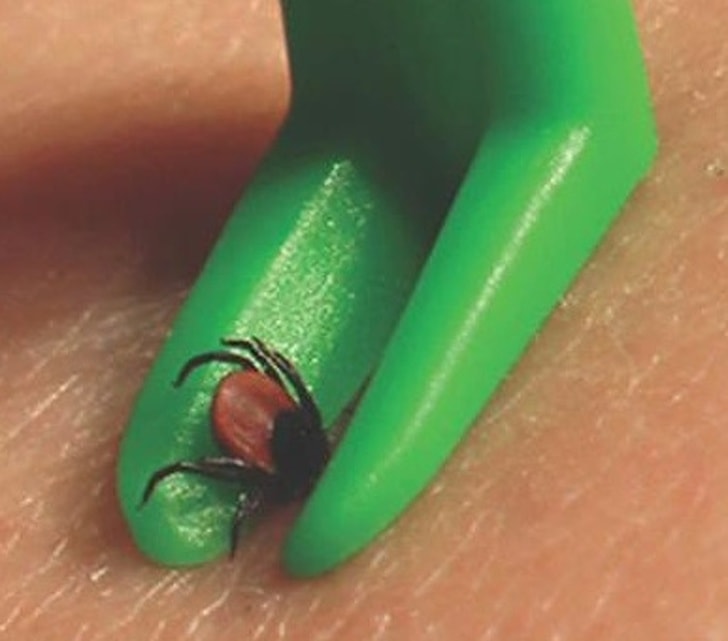 How to remove a tick