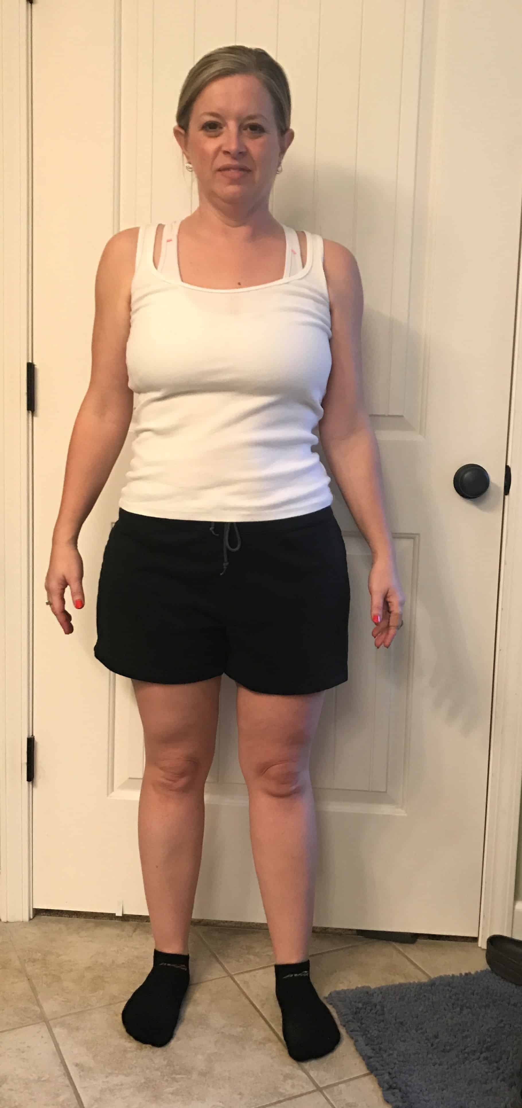 Medically Supervised Weight Loss • Bluegrass Medical Aesthetics