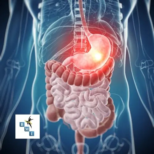 Laparoscopic Sleeve Gastrectomy BMI Surgical