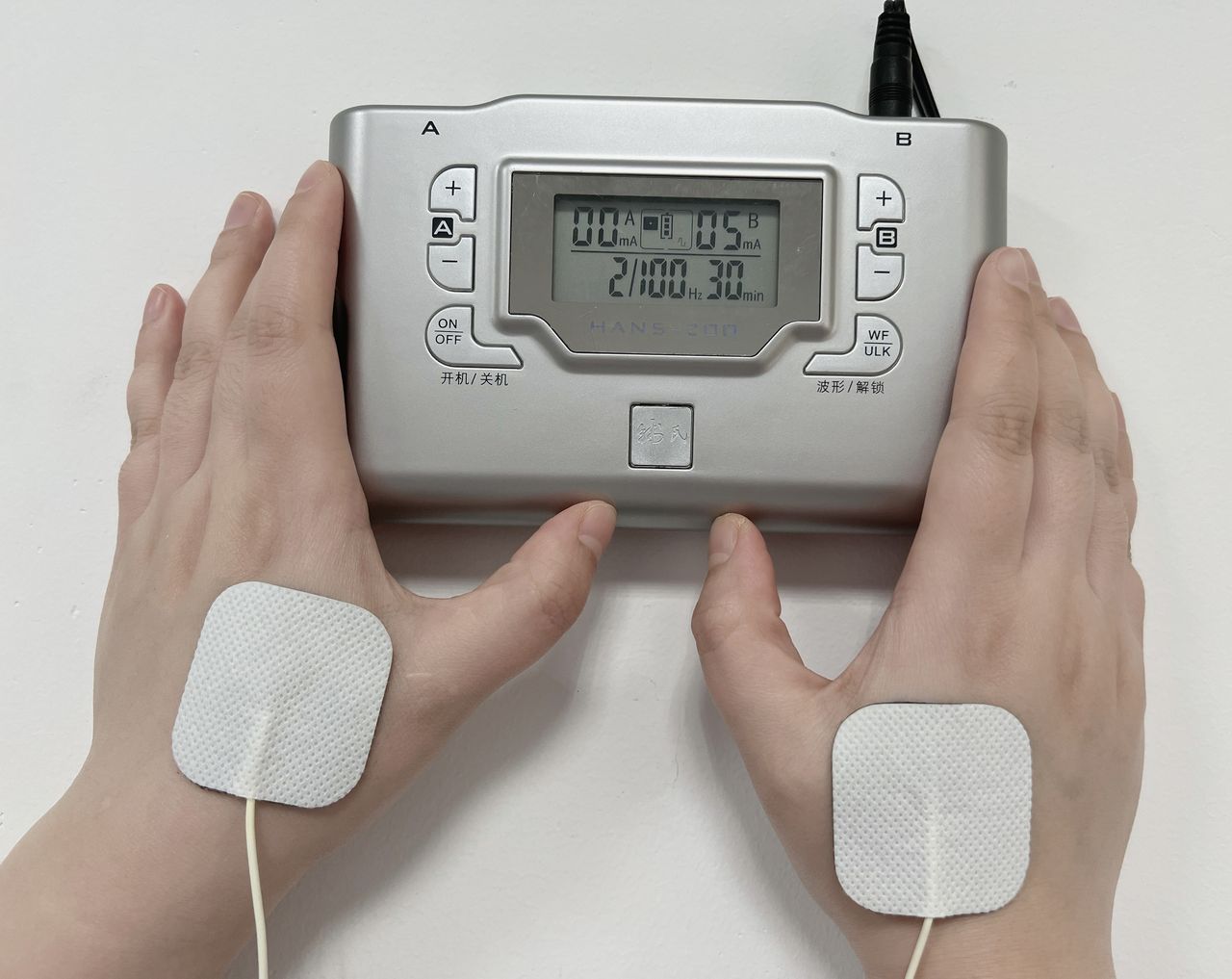 Efficacy and safety of transcutaneous electrical acupoints stimulation