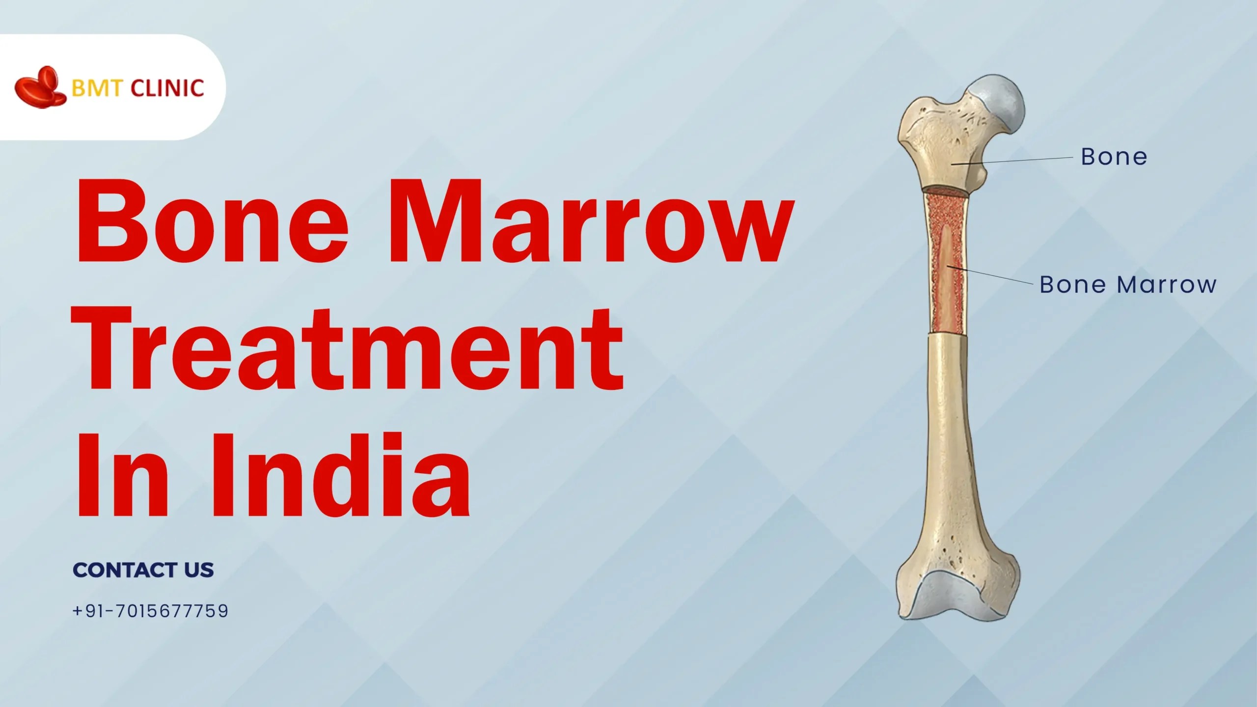 Bone Marrow Transplant Cost in India Stem Cell Transplant BMT Clinic