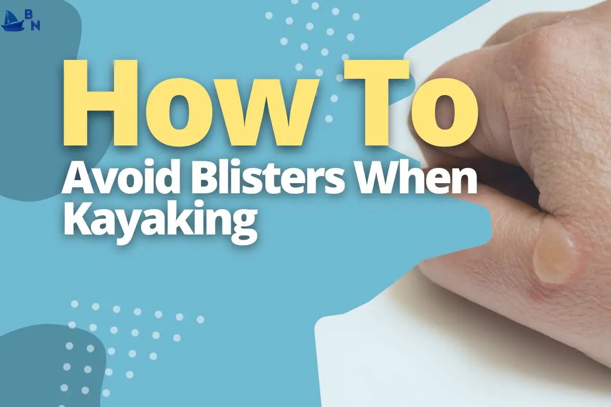 How To Avoid Blisters When Kayaking (Hint Don't Overdo It)