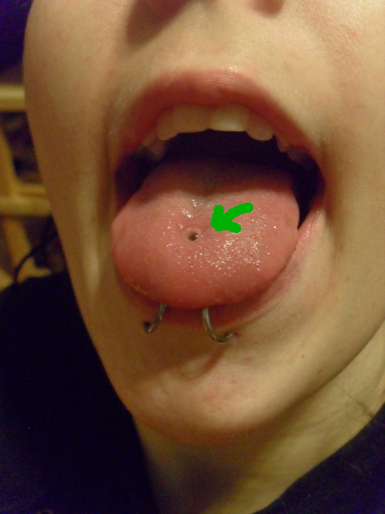 Quartz Glass Tongue Retainer