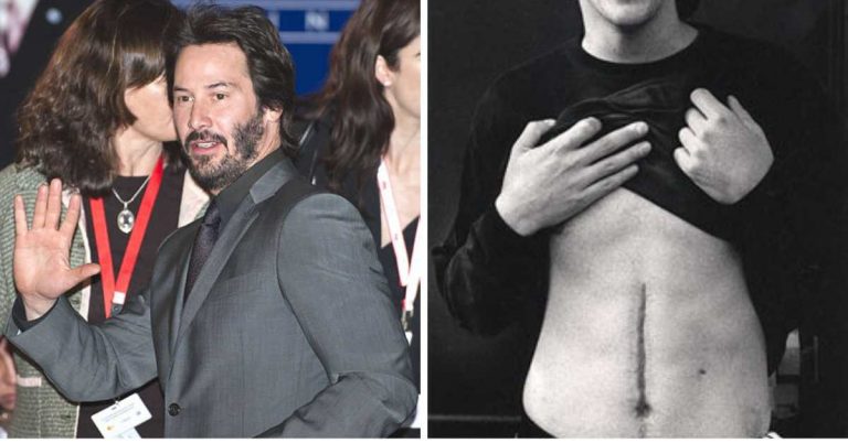 44 Celebrities With Scars Body Art Guru