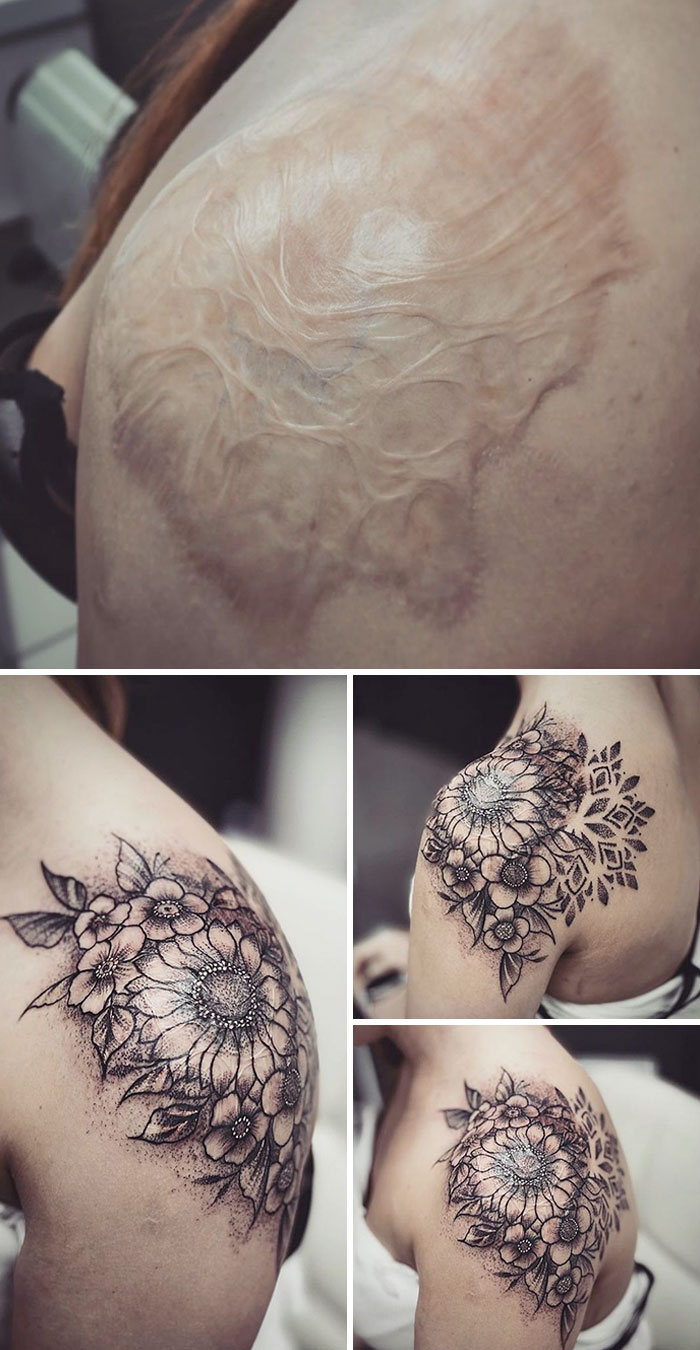 137 Cool Ideas For Hiding Scars With Tattoos - Body Art Guru 1350_x_700_jpg