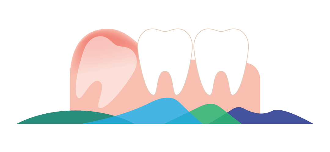 Oral Surgery Resource Guide Boise Oral Surgery & Dental Implant Center