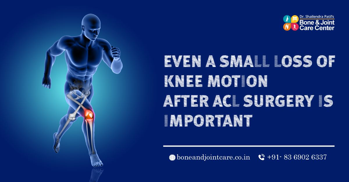 Can Even a Small Loss of Knee Motion After ACL Surgery In Mumbai Is