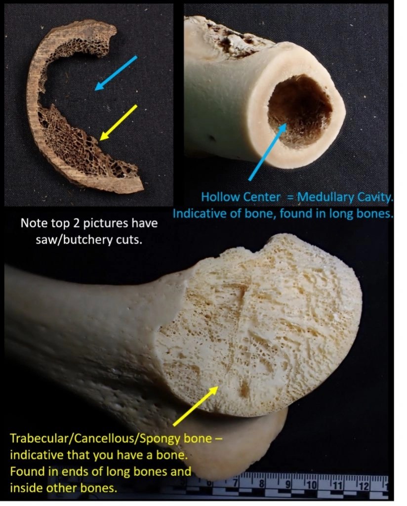 Using OsteoID OsteoID Bone Identification