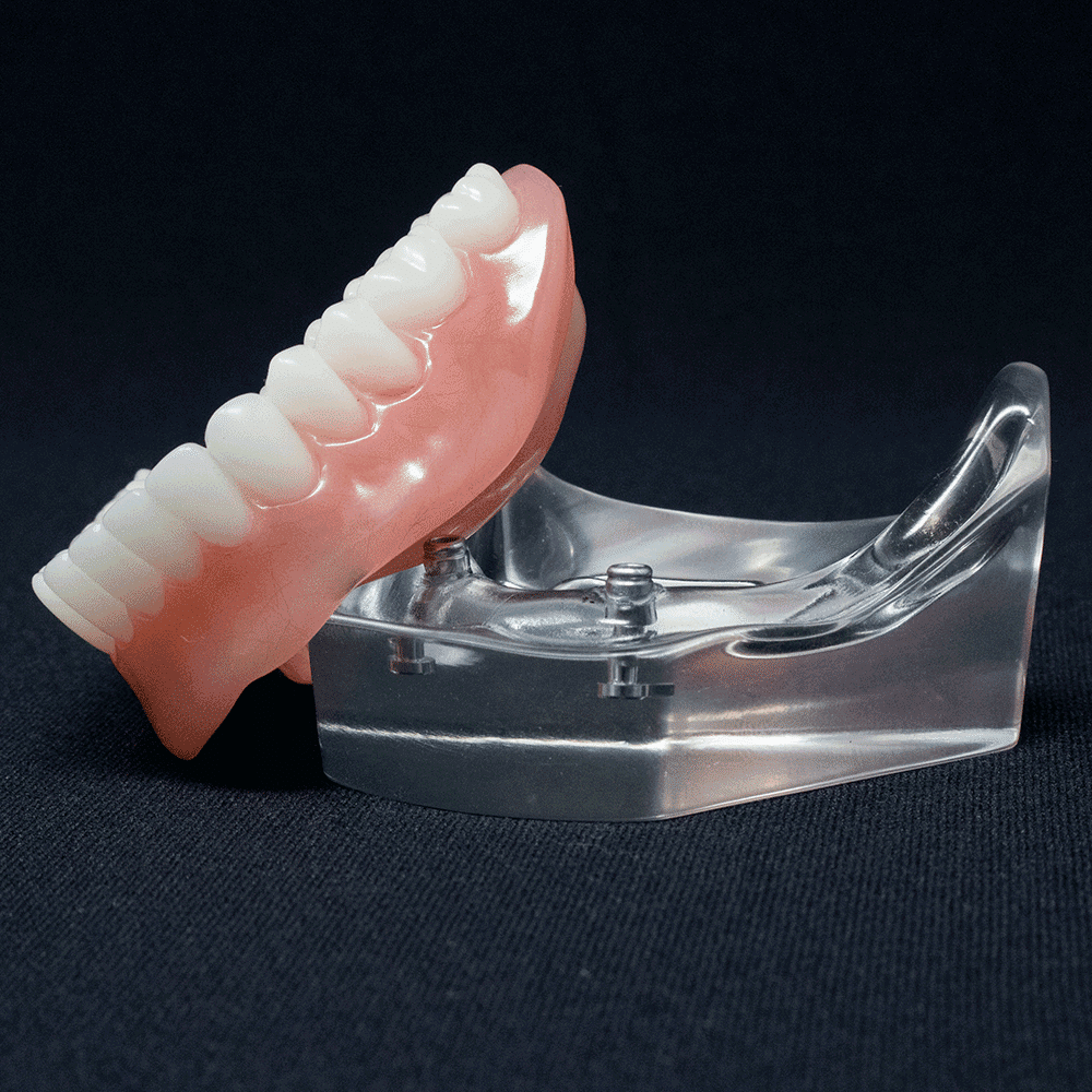 Two Implant Locator BoneModels™