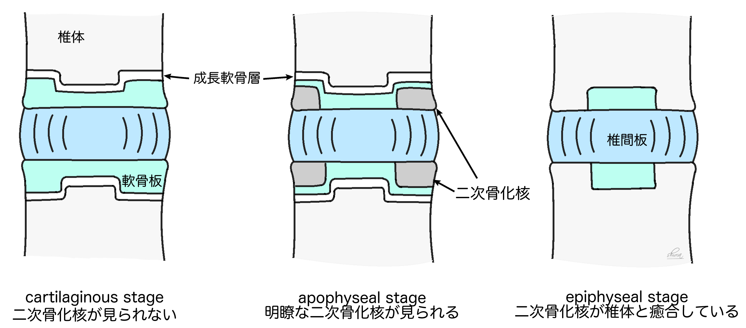 子供の腰痛 bonesetter's note