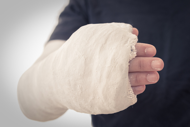 Plaster of Paris Once a Backbone of Orthopaedics Bonesurgeon