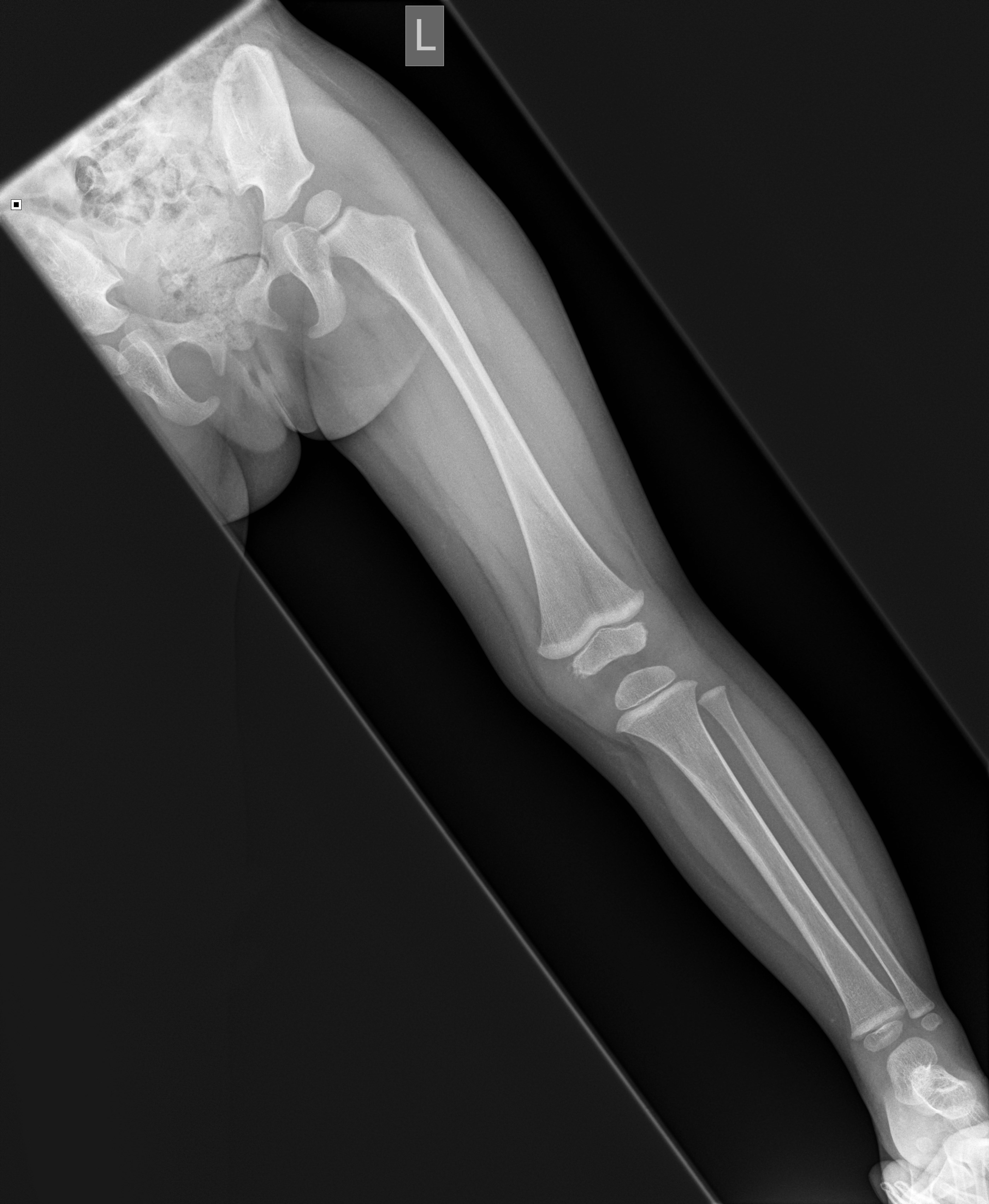 NORMAL PEDIATRIC BONE XRAYS
