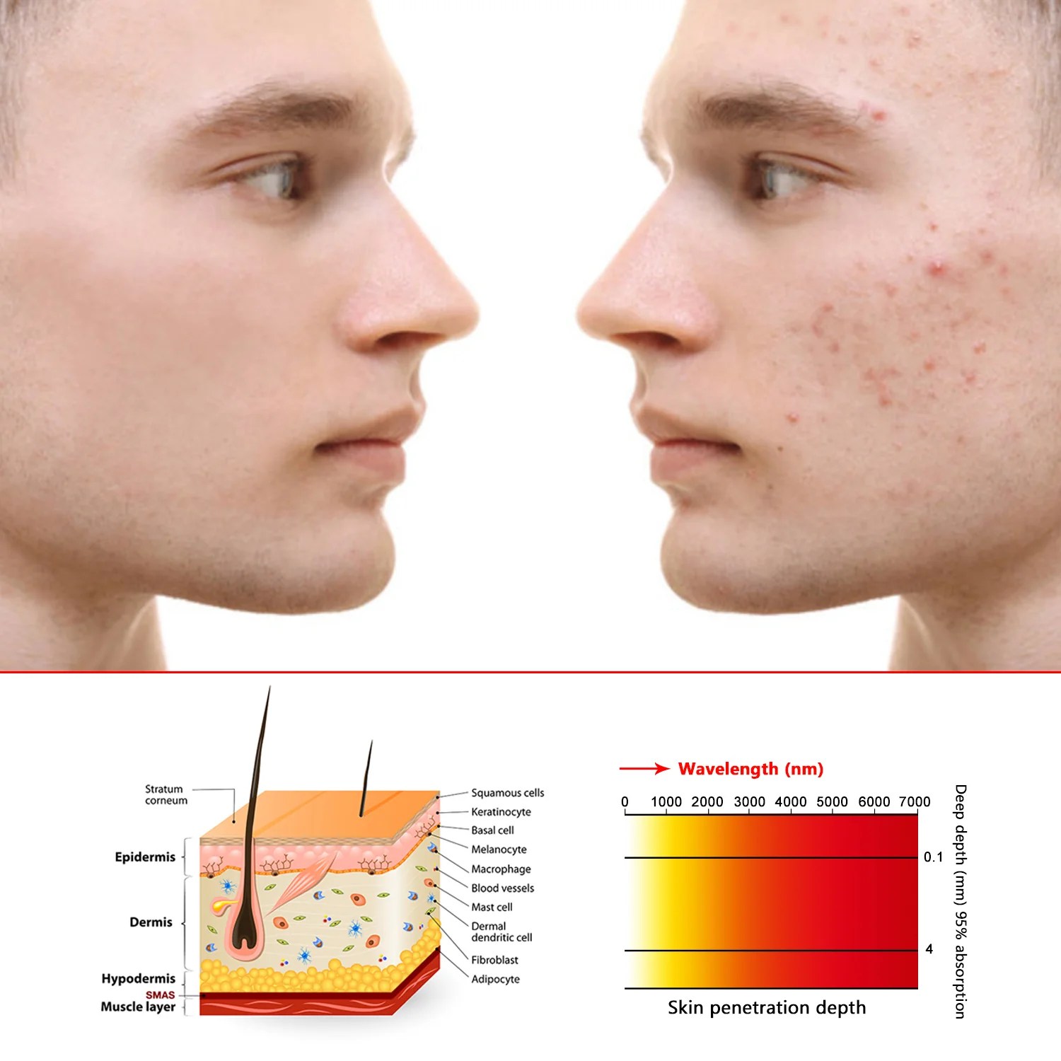 Benefits of Red Light Therapy Before or After Workout Bontanny