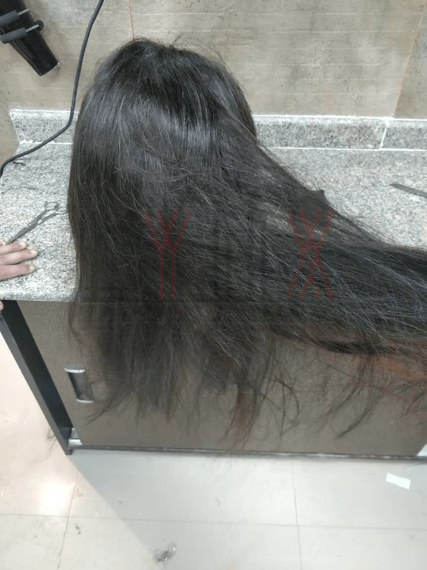 Prem Hair Expert LYNX Jaipur Wigs for Cancer patients in Jaipur