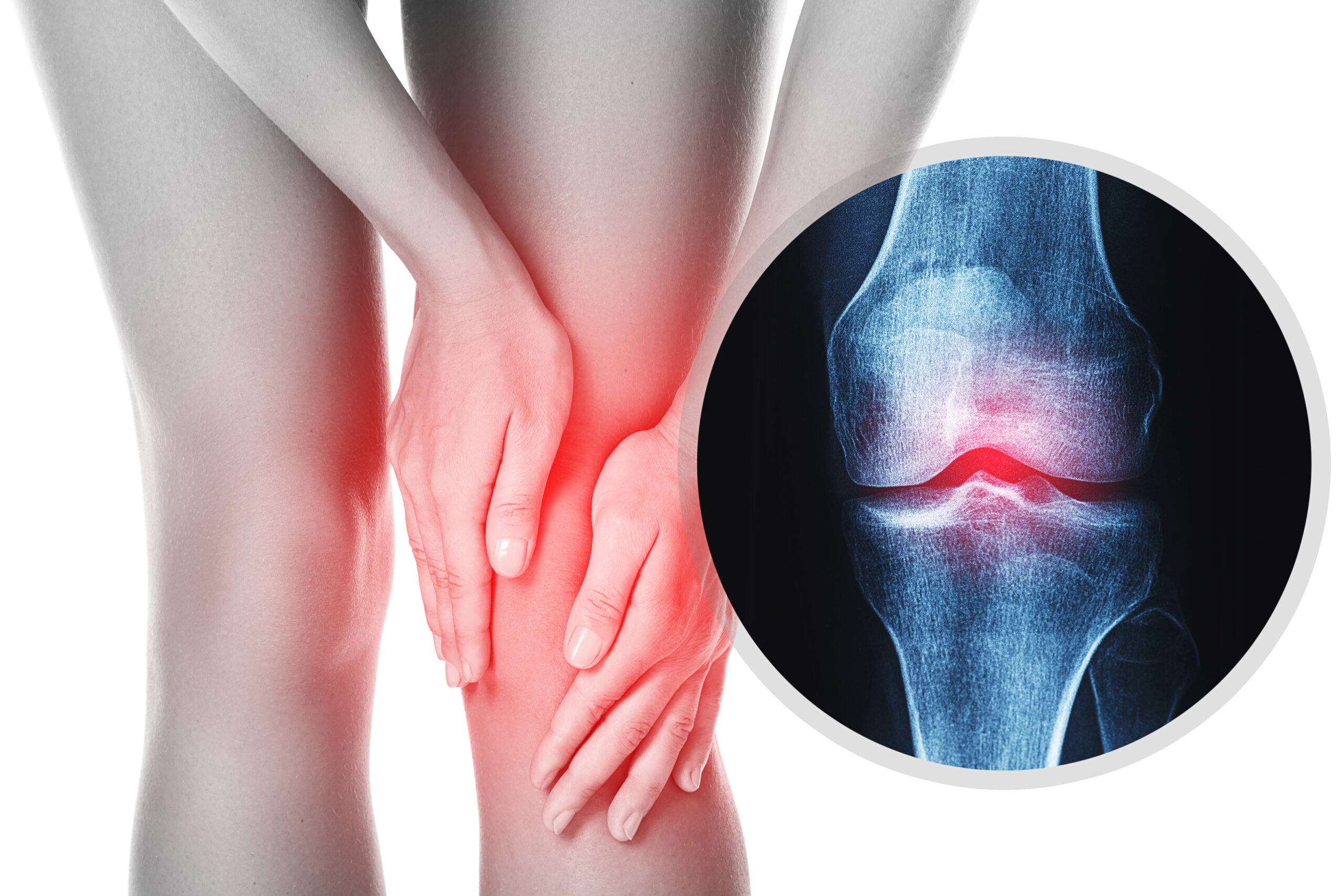 All You Need to Know About Osteoarthritis! Boost Physiotherapy Edmonton