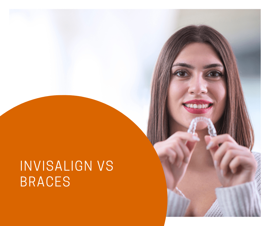 What are the advantages of Invisalign over braces Borders Orthodontics