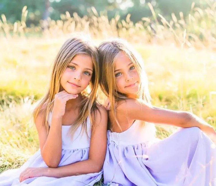 Dubbed “the most beautiful twins in the world” this is what the