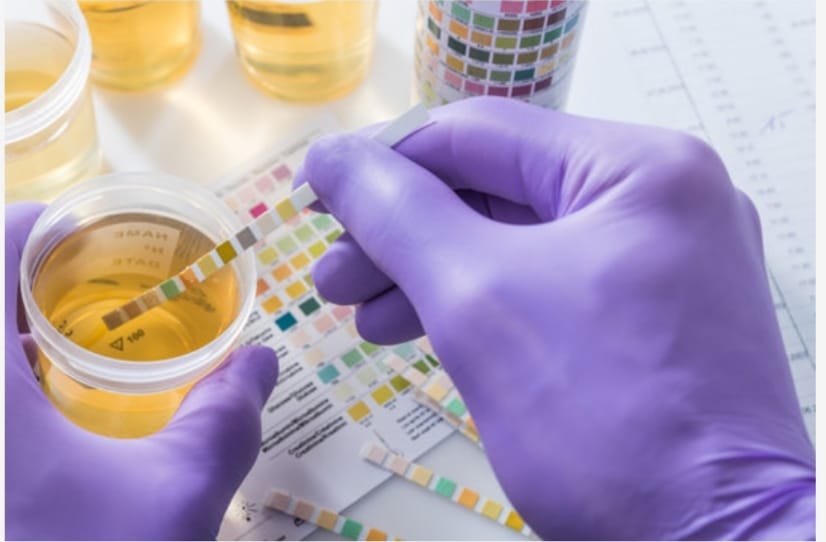 How To Use A Pregnancy Test Strip Steps You Need To Follow