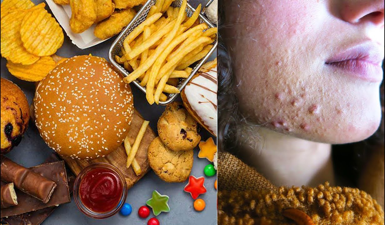 Poor diet, alcohol and your skin Bossface Cosmeceuticals